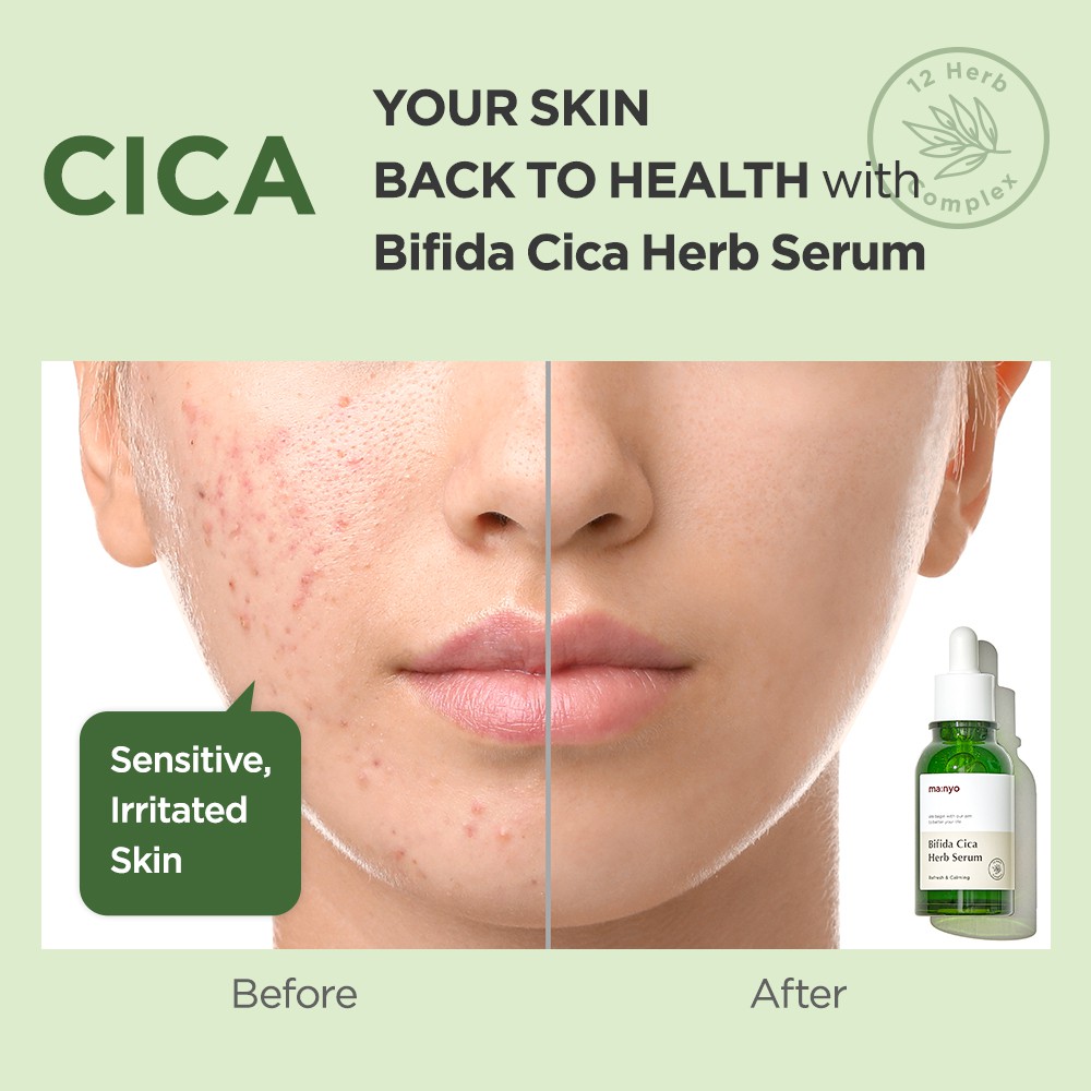 Manyo Bifida Cica Herb Serum 50ml | Hermo Online Beauty Shop Malaysia
